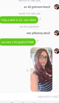????[KiK] のかわいい足の Hlly [露出] ????