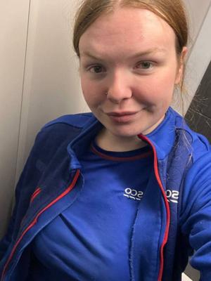 Tesco tetas( Abby)