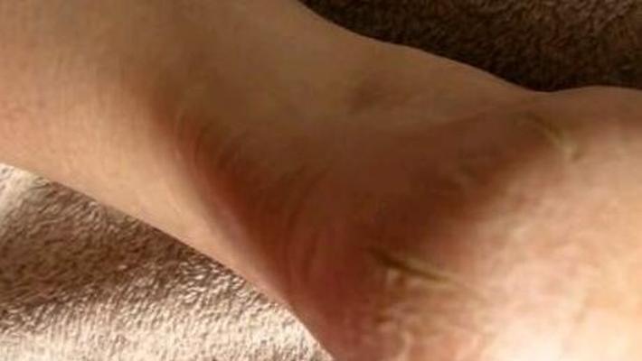 Sega sui piedi di una vecchia suora francescana