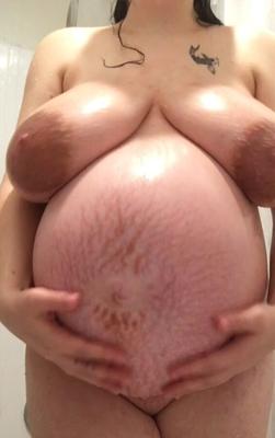 Pregnant stretch marks belly