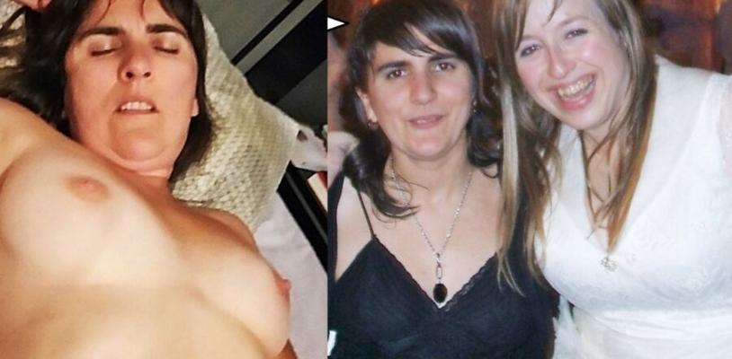 before and after wives tits