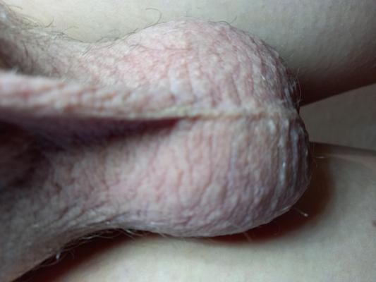 My testicles