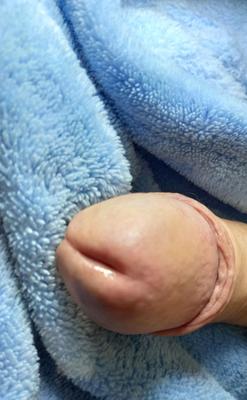 glans of my penis