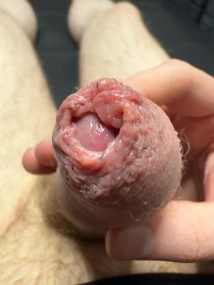 恥ずかしい写真