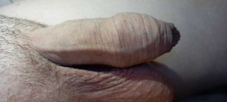 Big penis